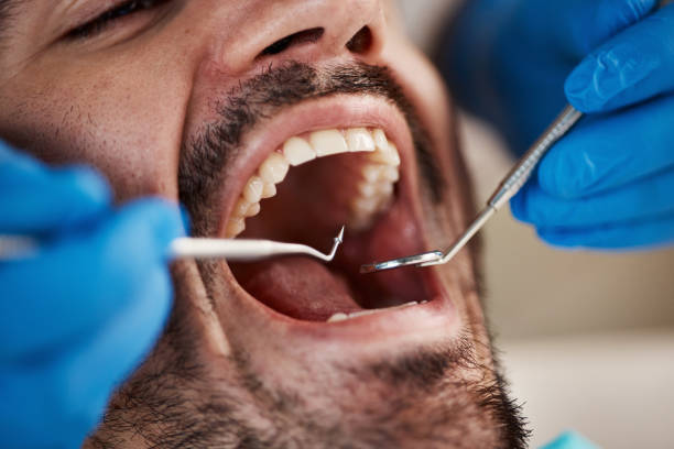 Best Emergency Dental Services for Seniors in Eddyville, IA