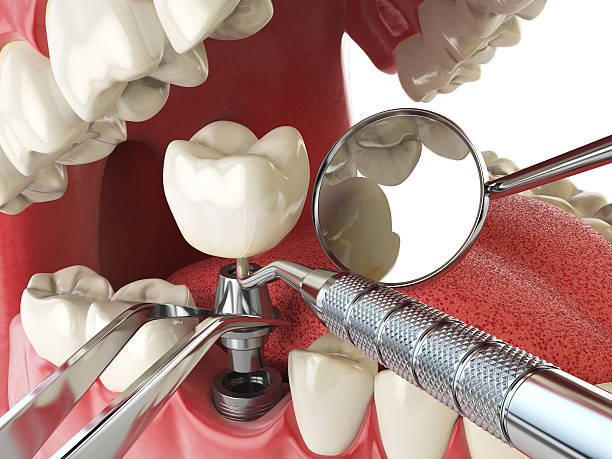 Best Broken or Cracked Tooth Emergency Dentist in Eddyville, IA