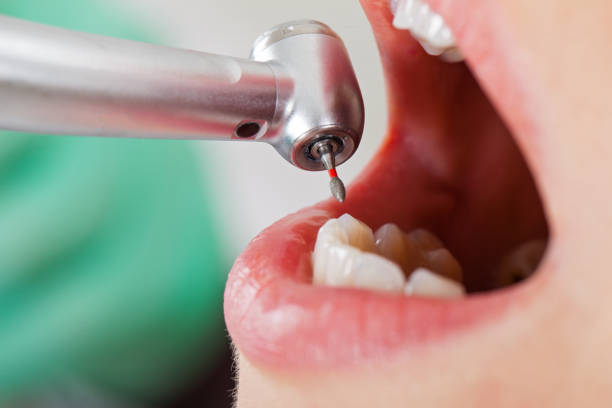 Best Emergency Dentist for Lost Fillings or Crowns in Eddyville, IA